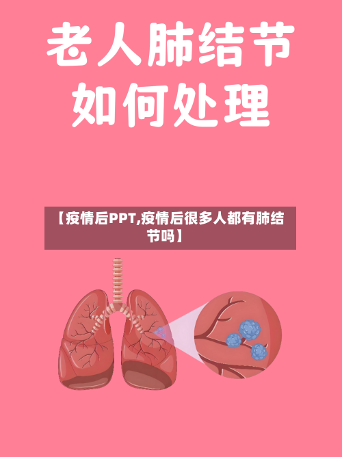 【疫情后PPT,疫情后很多人都有肺结节吗】