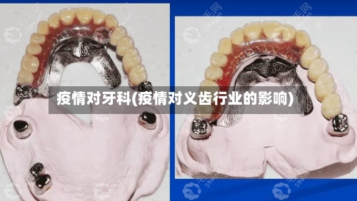 疫情对牙科(疫情对义齿行业的影响)