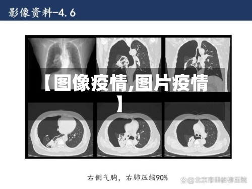 【图像疫情,图片疫情】