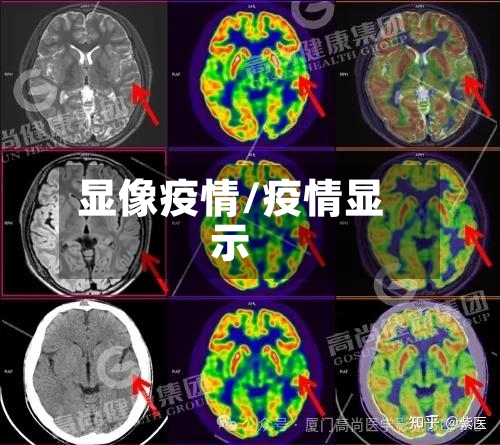 显像疫情/疫情显示