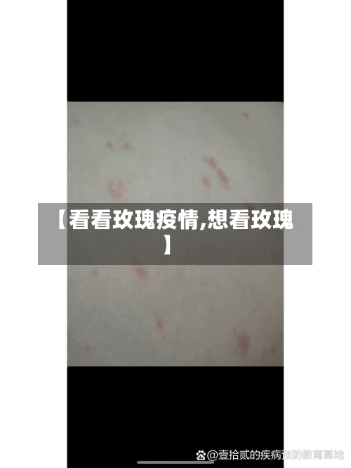 【看看玫瑰疫情,想看玫瑰】