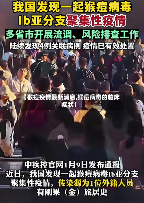 【猴痘疫情最新消息,猴痘病毒的临床症状】