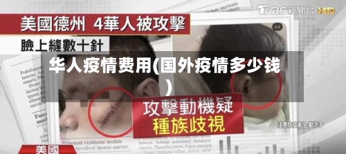 华人疫情费用(国外疫情多少钱)